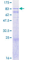 12.5% SDS-PAGE Stained with Coomassie Blue.